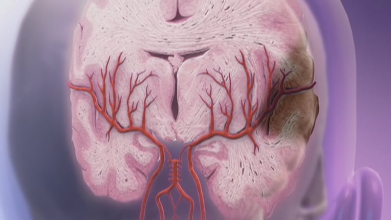 May is stroke awareness month