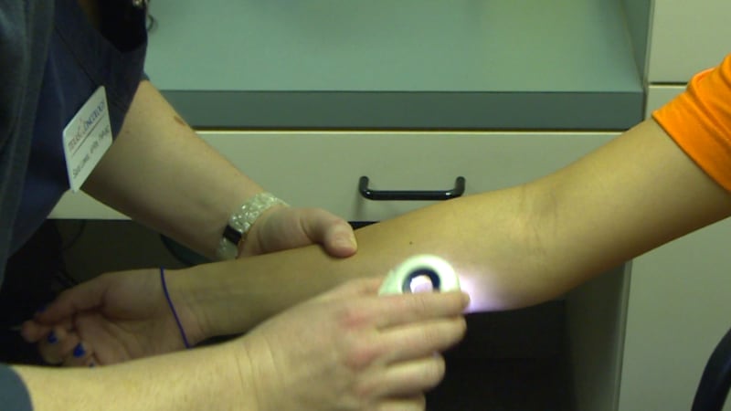 Summer intensifies heat and chances of skin cancer