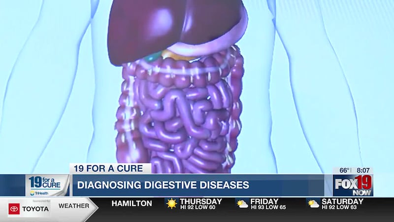 In our 19 for a Cure report, doctors discuss how to diagnose digestive diseases