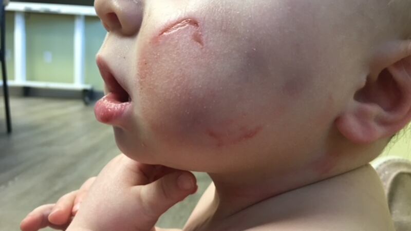 An Ohio mother claims someone abused her 1-year-old son while watching him at daycare.