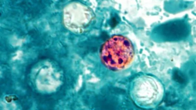 This photo of a stool sample shows four of the cyclospora parasites that cause the disease....