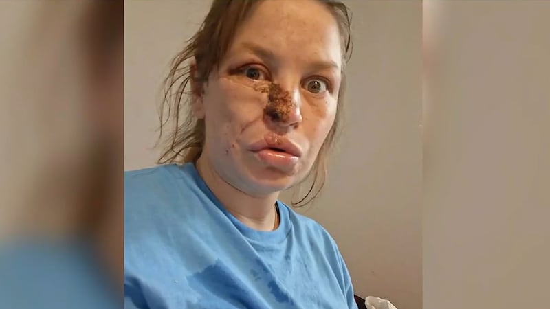 Audrey Austin, who is expecting twins, nearly lost her life when she was brutally attacked by...