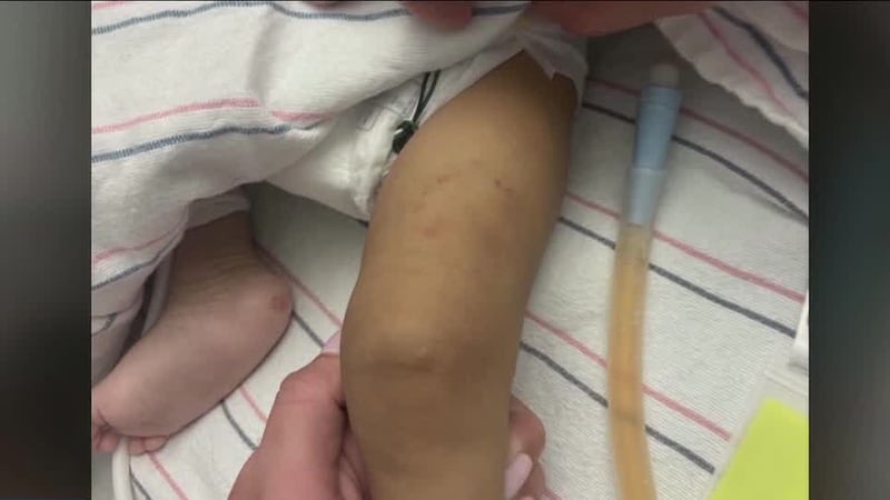 A babysitter is facing charges after she was accused of biting and injuring a 3-month-old boy...